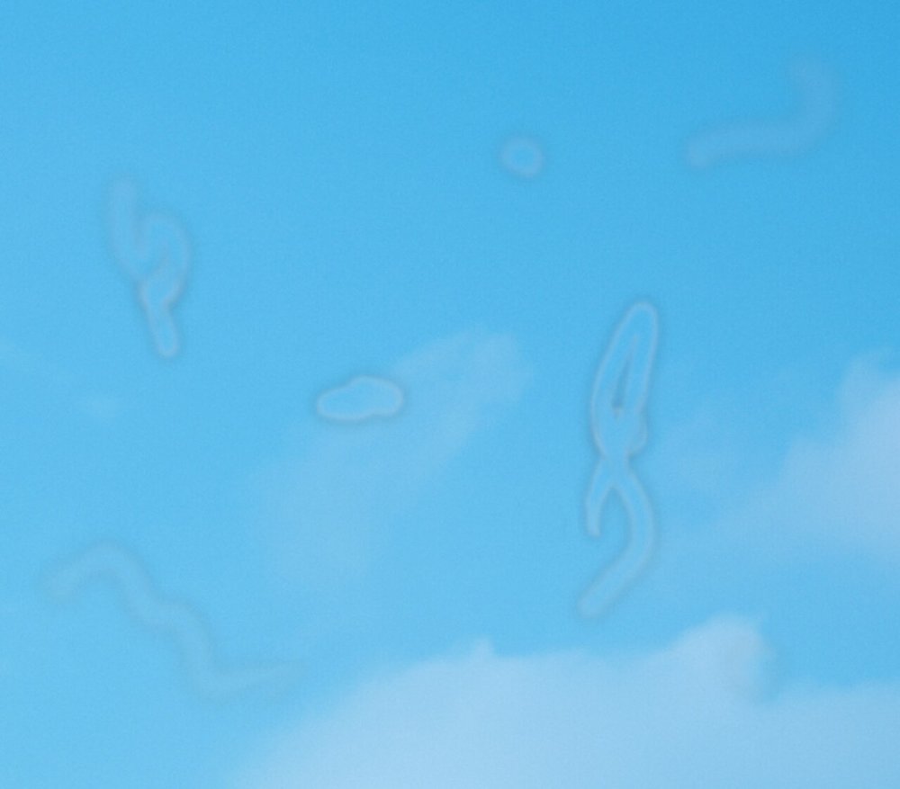 Artistic simulation of eye floaters (aankhon ke aage machhar): faint transparent threads and blobs drifting against a blue sky