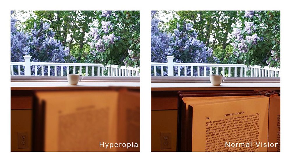 Vision comparison for hyperopia (long-sightedness): a book up close looks blurred while the garden in the distance stays sharp, next to the same view with normal vision