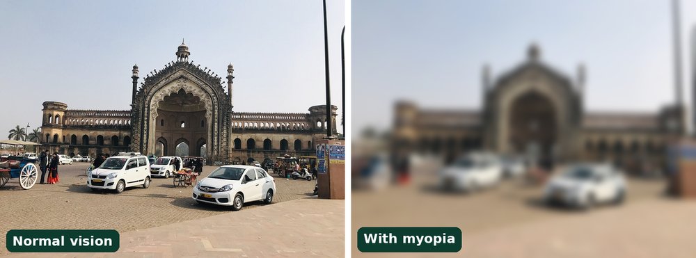 Simulation of myopia (nazar kamzor): Rumi Darwaza in Lucknow seen sharp with normal vision on the left and blurred in the distance with myopia on the right